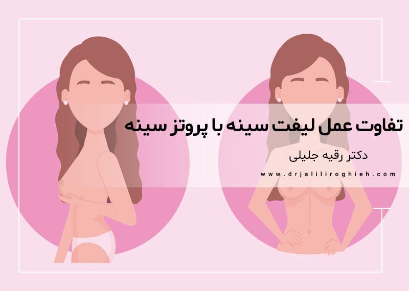 تفاوت عمل لیفت سینه با پروتز سینه