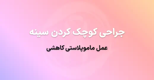 جراحی کوچک کردن سینه در تهران: عمل ماموپلاستی کاهشی